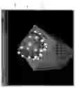 Fig. 06 - Methods for designing single cone bits and bits made using the methods