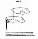 Fig. 07 - Spray-specs: a “pinch off” lens protection system, its method of attachment and removal, for safety glasses