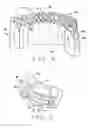Fig. 04 - Ring gear and manufacturing method for such a ring gear