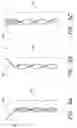Fig. 06 - Spinner bait blade