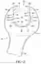 Fig. 03 - Wrench