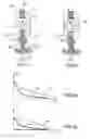 Fig. 02 - Made to an electromechanical valve actuator of an internal combustion engine
