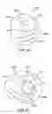 Fig. 45 - Bronchial flow control devices and methods of use