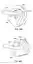 Fig. 46 - Bronchial flow control devices and methods of use
