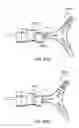 Fig. 49 - Bronchial flow control devices and methods of use