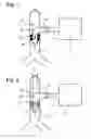 Fig. 02 - Tracheostomy tube