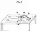 Fig. 06 - METHODS AND DEVICES FOR MAINTAINING AN OPEN AIRWAY