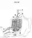 Fig. 08 - METHODS AND DEVICES FOR MAINTAINING AN OPEN AIRWAY
