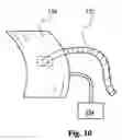 Fig. 09 - Device for treating keratin fibers