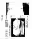 Fig. 26 - Method of causing intergranular stress corrosion crack to generate and grow in sample