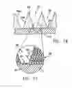 Fig. 09 - Brazed wick for a heat transfer device and method of making same