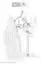 Fig. 07 - Apparatus for hunting in trees