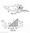 Fig. 06 - Cleaning process and apparatus for silicate materials