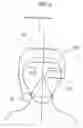 Fig. 07 - Device for assisting a person in rescue operations under hazardous situations