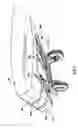 Fig. 06 - Canoe cart