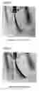 Fig. 04 - Actuator