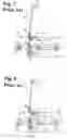 Fig. 07 - Overload/open-phase tripping device for circuit breaker