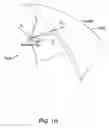 Fig. 12 - Wrap deformation using subdivision surfaces