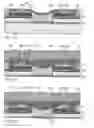 Fig. 09 - Inkjet nozzle chamber with electrostatically attracted plates