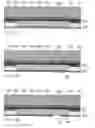 Fig. 76 - Inkjet nozzle chamber with electrostatically attracted plates