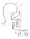 Fig. 01 - Method and apparatus for improving the operation of a remote viewing device by changing the calibration settings of its articulation servos