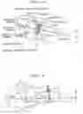 Fig. 11 - Apparatus and system for correction based upon detecting a camera shaking