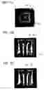Fig. 33 - Liquid crystal display having reflection electrodes