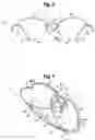 Fig. 05 - Hingeless eyeglasses frame
