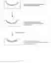 Fig. 10 - Tinted lenses and methods of manufacture