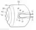 Fig. 01 - Bulk-shaped lens, light-emitting unit, and lighting equipment