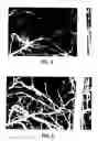 Fig. 07 - Volumetric X-ray imaging system with automatic image resolution enhancement