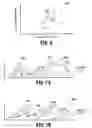 Fig. 07 - Registration of scanning data acquired from different patient positions