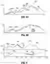 Fig. 08 - Registration of scanning data acquired from different patient positions