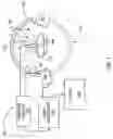 Fig. 02 - Method and apparatus for instrument tracking on a scrolling series of 2D fluoroscopic images