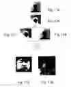 Fig. 12 - Detecting human faces and detecting red eyes