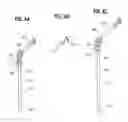 Fig. 08 - Confined space entry device and safety line for fall arrest