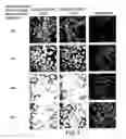 Fig. 08 - Preblocking with non-ha gags increases effectiveness of ha conjugated anticancer agents