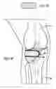 Fig. 02 - Bone restorative carrier mediums