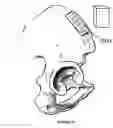 Fig. 24 - Bone restorative carrier mediums
