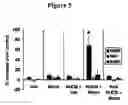 Fig. 05 - Methods for enhancing neuroprotection via administration of stem cells and blood brain barrier permeabilizers