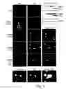 Fig. 04 - Substances directed against a specific sequence essential for heparanase catalytic activity and uses thereof as heparanase inhibitors