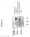 Fig. 23 - Compositions comprising antibodies to human FgI2