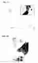 Fig. 02 - Antibodies which bind to proteins involved in cytoadhesion of plasmodlum falciparum ring-stage-infected erythrocytes