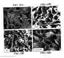 Fig. 13 - Antibodies which bind to proteins involved in cytoadhesion of plasmodlum falciparum ring-stage-infected erythrocytes