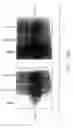Fig. 09 - PSCA: prostate stem cell antigen and uses thereof in pancreatic cancer