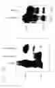 Fig. 16 - PSCA: prostate stem cell antigen and uses thereof in pancreatic cancer