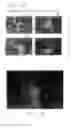 Fig. 34 - PSCA: prostate stem cell antigen and uses thereof in pancreatic cancer