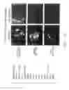 Fig. 43 - PSCA: prostate stem cell antigen and uses thereof in pancreatic cancer