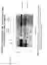 Fig. 70 - PSCA: prostate stem cell antigen and uses thereof in pancreatic cancer