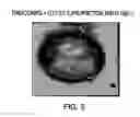 Fig. 04 - Liposomal vaccine
